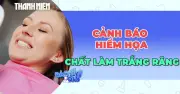 Cảnh báo tác dụng phụ và nguy cơ từ sản phẩm làm trắng răng