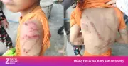 Công an Đắk Lắk vào cuộc điều tra vụ bé trai 10 tuổi bị bạo hành chi chít vết thương