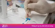 Hành trình từ bóng tối đến ánh sáng của người đàn ông sống chung với HIV