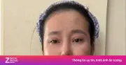 Nữ bị can phẫu thuật thẩm mỹ để trốn truy nã vẫn bị bắt tại Vĩnh Long