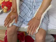 Thanh niên bị nhóm cướp tấn công trên đường về quê ăn Tết, xuất viện sau hơn 10 ngày