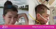 Tiếp viên hàng không bỏng 80% cơ thể vì cứu hôn phu chuẩn bị trở lại sân khấu