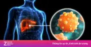 Viêm gan B, C: Dấu hiệu âm thầm và nguy cơ ung thư gan tại Việt Nam