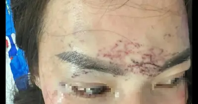 Cà Mau: Hai phụ nữ lĩnh án tù vì đánh ghen, xăm mặt nạn nhân tại cơ sở thẩm mỹ