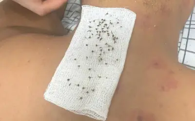 Cha Con Bị Hàng Trăm Nốt Ong Đốt, Nguy Kịch Vì Phản Vệ Tại Phú Thọ