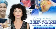 Căng Da Mặt Deep Plane: Giải Pháp Trẻ Hóa Từ Cấu Trúc Sâu, Tự Nhiên Và Lâu Dài