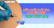 Cảnh báo ung thư da: Tỷ lệ sống sót 99% nếu phát hiện sớm, nhưng hàng nghìn người vẫn chủ quan
