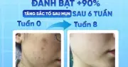 Kem Mờ Sẹo Scar Esthetique: Bí Quyết Làm Đẹp Da Được Chuyên Gia Tin Dùng