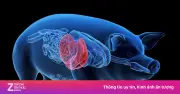 Lần Đầu Tiên Ghép Gan Lợn Biến Đổi Gene Cứu Sống Bệnh Nhân Suy Gan Chờ Ghép Tạng