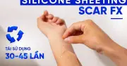 Miếng dán ép sẹo Rejuvaskin Scar FX: Bí quyết đứng top bán chạy nhờ công nghệ silicone y tế