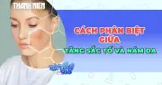 Phân Biệt Tăng Sắc Tố, Nám Da: Bản Chất Khác Biệt Và Cách Xử Lý Đúng