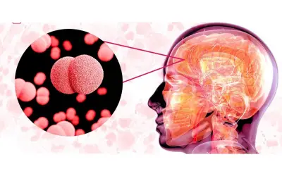 Bệnh não mô cầu gia tăng ở Đông Nam Bộ: Nguy cơ bùng phát dịch và biện pháp phòng ngừa