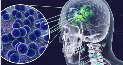 Cà Mau: 2 ca dương tính viêm não mô cầu, 1 tử vong, ngành y tế khẩn trương kiểm soát