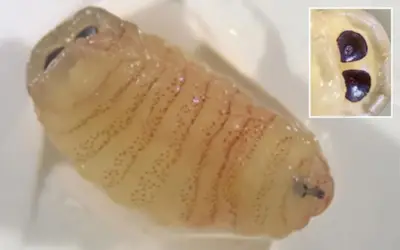 Ca bệnh hy hữu: Ấu trùng ruồi ký sinh trong mũi người phụ nữ Hy Lạp