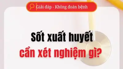Các Xét Nghiệm Cần Thiết Để Phát Hiện Sốt Xuất Huyết Chính Xác