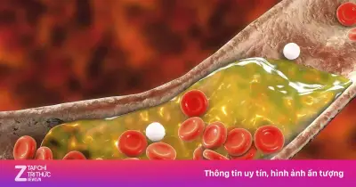 Cảnh báo: 6 loại thịt quen thuộc trong bữa cơm Việt có thể khiến mỡ máu tăng vọt