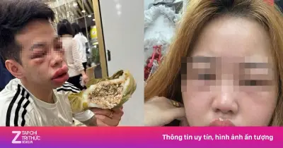 Cảnh báo dị ứng bánh trứng kiến: Nhiều người sưng mặt, mắt híp tịt sau khi ăn