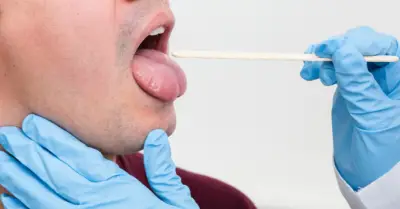 Lưỡi có rêu trắng dày: Dấu hiệu cảnh báo hệ tiêu hóa đang gặp vấn đề?