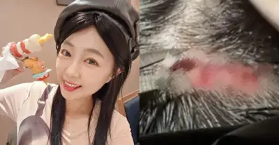 Nữ diễn viên 38 tuổi ngã đập đầu, khâu 5 mũi ngay sinh nhật