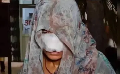 Người chồng ở Ấn Độ cắn rách mặt vợ trong cuộc cãi vã gia đình dữ dội