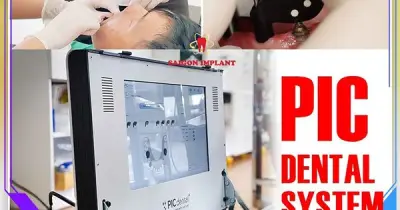 Nha khoa Saigon Implant định hình chuẩn mới với công nghệ PIC Dental và Face Scan 3D