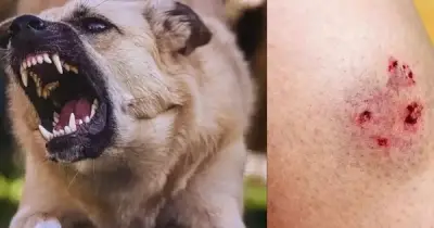 Quảng Ngãi: Xác nhận chó dại tấn công người, ngành chức năng khẩn trương xử lý ổ dịch