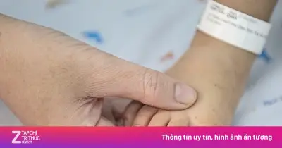 TP.HCM Siết Chặt Phòng Chống Bệnh Tay Chân Miệng Trong Trường Học