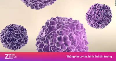 Virus EV71: Mối đe dọa thầm lặng với trẻ mắc tay chân miệng và diễn tiến nhanh chóng