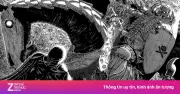 Bí Mật Đằng Sau 'Berserk': Tác Giả Kentaro Miura Lấy Cảm Hứng Từ Disney