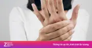 Bàn Tay 'Kêu Cứu': 5 Dấu Hiệu Bất Thường Cảnh Báo Bệnh Nguy Hiểm