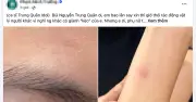 Công An TP.HCM vào cuộc điều tra nghi vấn Trung Quân Idol hành hung nữ bác sĩ