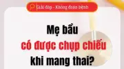 Mẹ bầu có được chụp chiếu khi mang thai? Lời khuyên từ chuyên gia