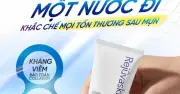 Sau mụn: Lý do làn da khó phục hồi và giải pháp bền vững từ chuyên gia