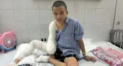 Tai nạn điện cao thế cướp 1/3 cánh tay phải, tương lai cậu bé 16 tuổi chênh vênh