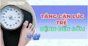 Tăng cân khi còn trẻ: Khởi đầu âm thầm của bệnh mạn tính