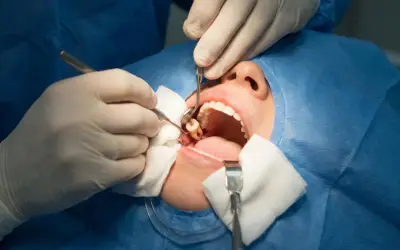 Bệnh nhân tố bác sĩ nhổ nhầm răng khỏe ở Ấn Độ