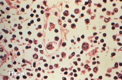 Thái Lan xếp virus Hanta vào nhóm bệnh truyền nhiễm nguy hiểm