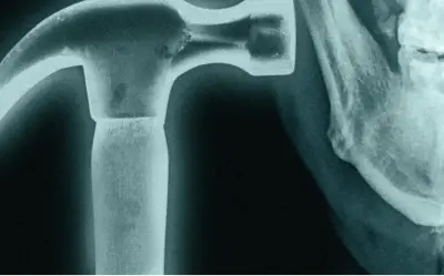 Trào lưu 'đập xương mặt' gây sốc trên TikTok: Nguy hiểm khôn lường