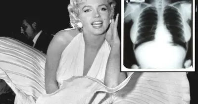 Đấu giá phim X-quang của Marilyn Monroe gây tranh cãi