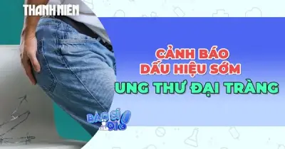 Ung thư đại tràng: Dấu hiệu sớm dễ nhầm với bệnh thông thường