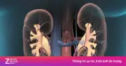 3 dấu hiệu thận 'kêu cứu' thường bị bỏ qua: Thiếu máu, đau xương, huyết áp cao