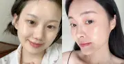 5 serum chống lão hóa giúp da căng bóng, trẻ hóa không cần filler