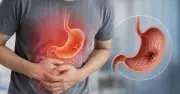 6 dấu hiệu sớm của ung thư dạ dày dễ bị bỏ qua, nhiều người Việt chủ quan
