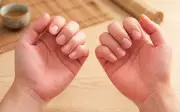 6 dấu hiệu trên bàn tay cho thấy sức khỏe tốt