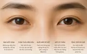 7 dấu hiệu cảnh báo phổi đang có vấn đề bạn không nên bỏ qua