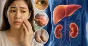 8 dấu hiệu suy gan, thận thường bị bỏ qua: Quan sát bụng và da để nhận biết