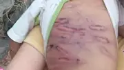 Bé 2 tuổi bị bạo hành: Cục Bà mẹ và Trẻ em yêu cầu xác minh