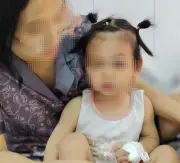 Bé gái 22 tháng tuổi nhập viện khẩn cấp vì bị chó cắn nghiêm trọng vùng hàm mặt