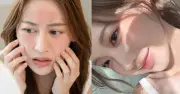 Bổ sung collagen có thực sự giúp da đẹp? Sự thật bất ngờ