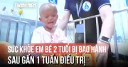 Bé trai 2 tuổi bị bạo hành đã cười nói sau 1 tuần điều trị